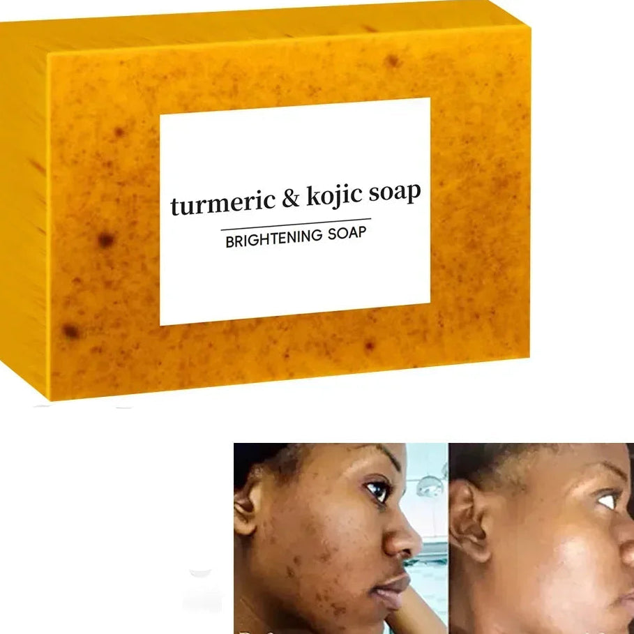 Sabonete artesanal de cúrcuma e ácido kójico