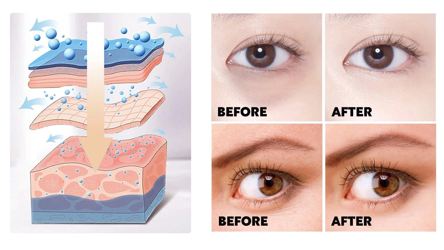 Bastão de colágeno Caracol